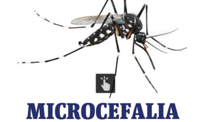 Van cuatro casos de microcefalia asociadas al zika en Panam