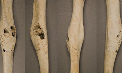 Extrao descubrimiento en huesos hallados en Panam