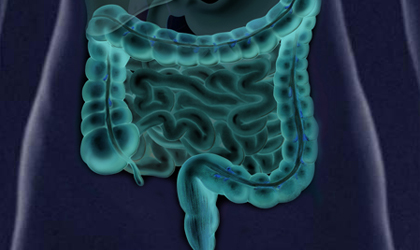 Sntomas que reflejan unos intestinos enfermos
