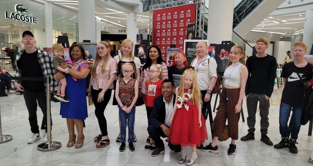 Con Arte celebran el Da Mundial del Albinismo en Albrook