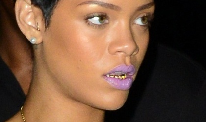 Rihanna estrena dientes de Oro