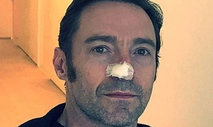 Hugh Jackman, de nuevo pas por el quirfano