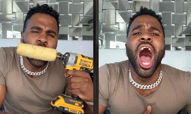 Jason Derulo hizo creer a sus fans en TikTok, que perdi los dientes