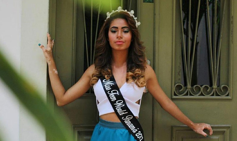 Miss Turismo Panam es excluida por padecer de vitligo