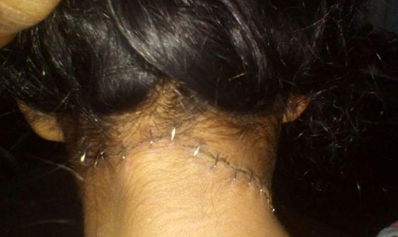 Muchacha atacada a machetazos da gracias a Dios por estar viva