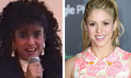Shakira, podra haber pasado por el quirfano para mejorar o eliminar algunas imperfecciones