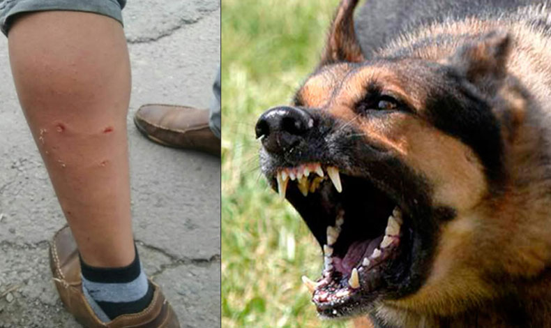 Colaborador que recolecta la basura fue atacado por canino