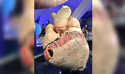 Exhiben enorme corazn de ballena azul tan grande como un pony