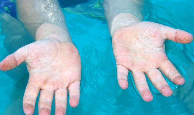 Sabes por qu nuestras manos se arrugan con el agua?