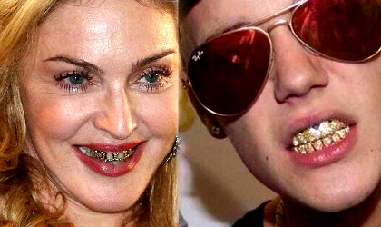 Dientes de oro: La moda entre los famosos