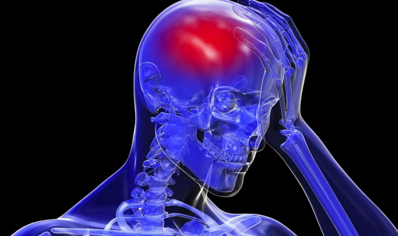 �C�mo prevenir un EVC o �stroke�?