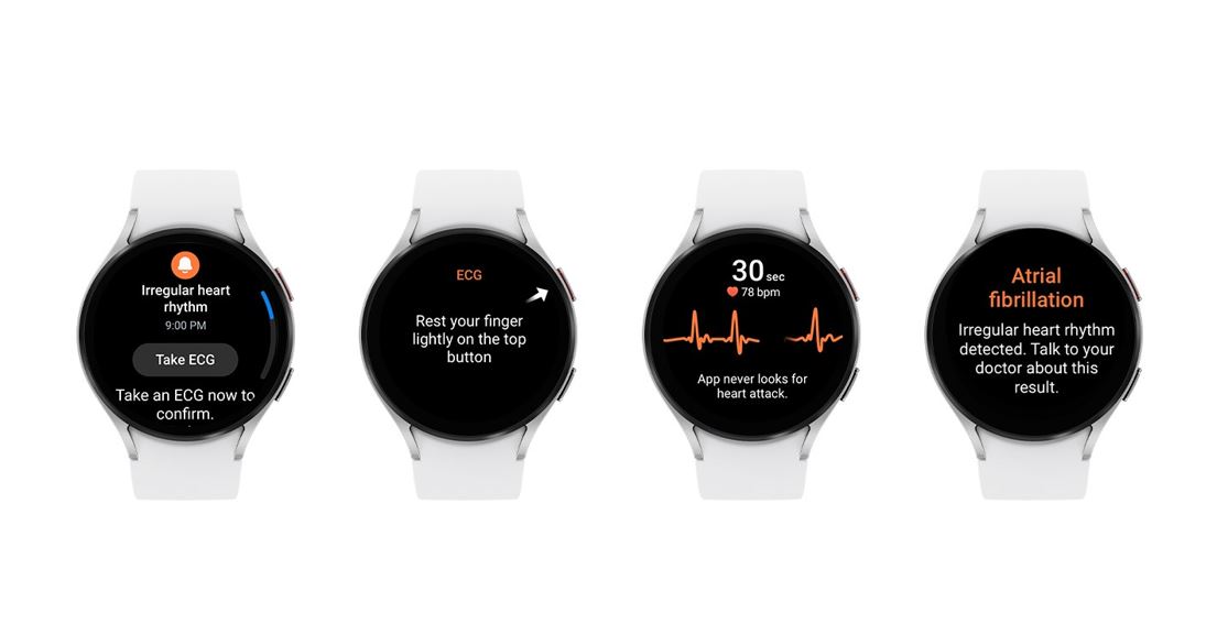 Samsung anuncia la Notificacin de Ritmo Cardaco Irregular aprobada por la FDA para Galaxy Watch