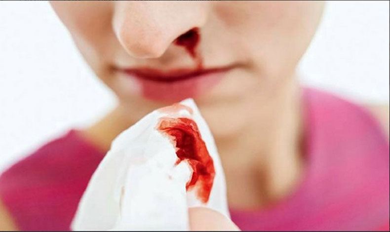 Opciones para mejorar la calidad de vida a enfermos de hemofilia