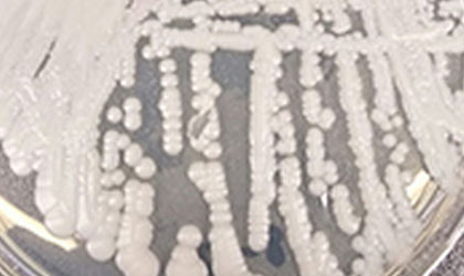 En el Hospital Santo Toms existe presencia del hongo Candida Auris