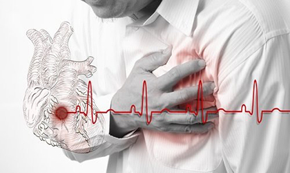 Desarrollan una Inteligencia Artificial capaz de predecir infartos