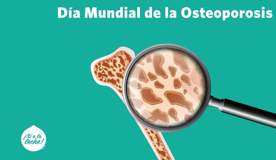 Aumentar el consumo de calcio para una buena salud sea