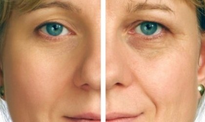 Dile Adi�s A Las Ojeras