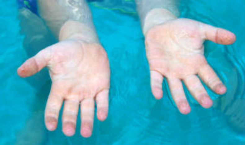 Sabes por qu se arrugan los dedos en el agua?