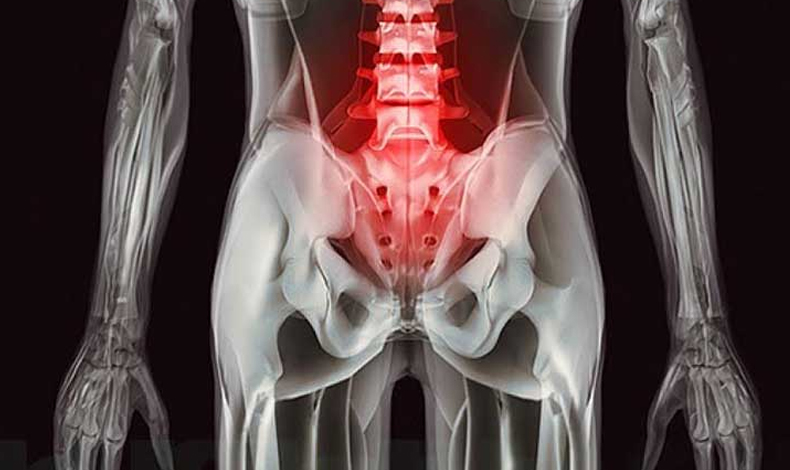 Estos rayos X cambiaran tu forma de ver el cuerpo humano