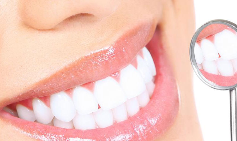 Sabes en que consiste la gingivitis?
