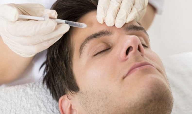 Beneficios del botox masculino