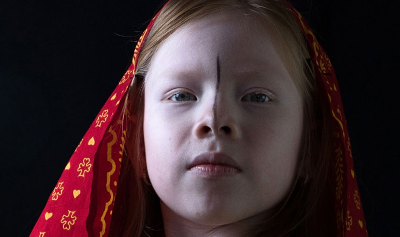 SOS Albinos Panam