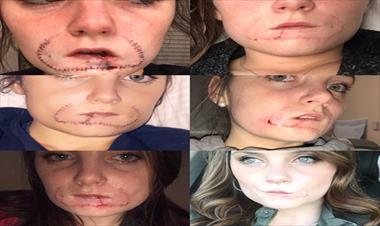 /vidasocial/hombre-que-le-mordio-el-labio-a-su-ex-novia-ira-a-prision-por-brutal-ataque/82967.html