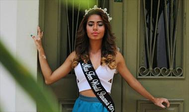 /vidasocial/miss-turismo-panama-es-excluida-por-padecer-de-vitiligo/84624.html