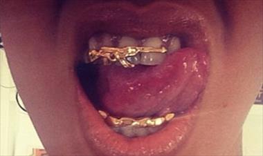 /vidasocial/rihana-tiene-armas-hasta-en-los-dientes/21519.html