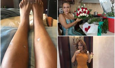 /vidasocial/sandra-sandoval-aparece-en-las-redes-mostrando-su-recuperacion/77294.html