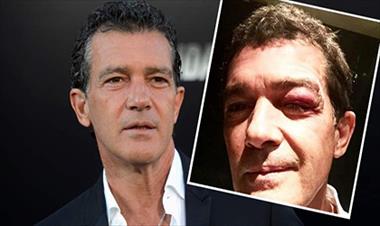 /vidasocial/pequeno-accidente-de-antonio-banderas-en-filmacion/35410.html