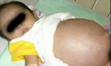 /vidasocial/llevaron-a-su-bebe-al-medico-por-un-tumor-y-lo-que-encontraron-fue-sorprendente/46670.html