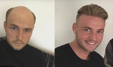 /spotfashion/la-solucion-a-la-calvicie-son-estos-peluquines-inspirados-en-el-cabello-de-david-beckham/51341.html