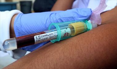 /vidasocial/censo-de-salud-revela-tendencia-sobre-colesterol-en-la-sangre/49985.html