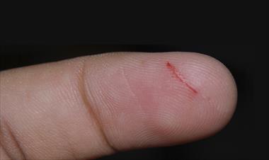 /vidasocial/-sabes-por-que-duele-tanto-cortarse-con-papel-/65728.html