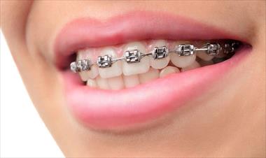 /spotfashion/riesgos-para-la-salud-colocarse-brackets-sin-medidas-de-bioseguridad/71180.html