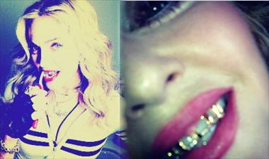 /vidasocial/madonna-se-une-a-la-moda-del-diente-de-oro/21582.html