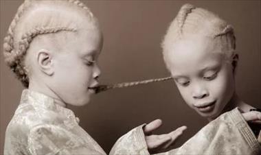 /spotfashion/estas-gemelas-con-albinismo-estan-triunfando-en-el-mundo-de-la-moda/50927.html