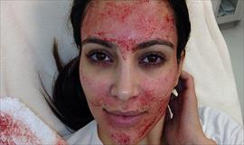 Kim Kardashian se arrepiente del ‘facial vampiro’