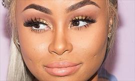 Blac Chyna pas por el quirfano para disminuir algunas partes de su cuerpo