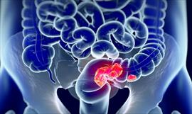 Cuida tu salud! Conoce ms del Cncer de Colon