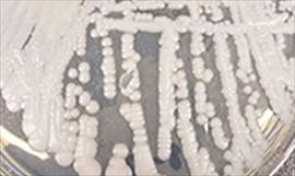 Paro de mdicos afecta consultas externas