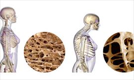 Cmo prevenir la osteoporosis?