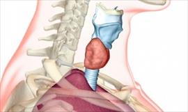 Endocrinloga panamea explica importancia de la tiroides para el metabolismo